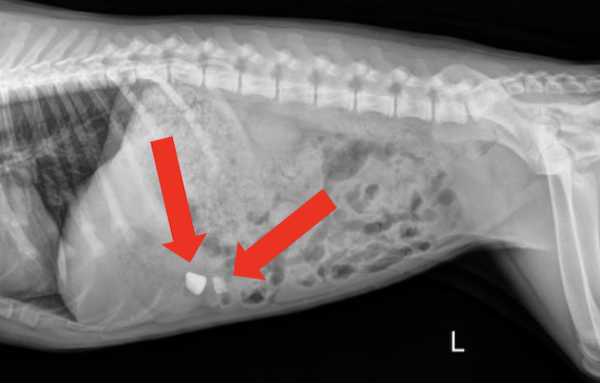 Left Lateral Abdomen