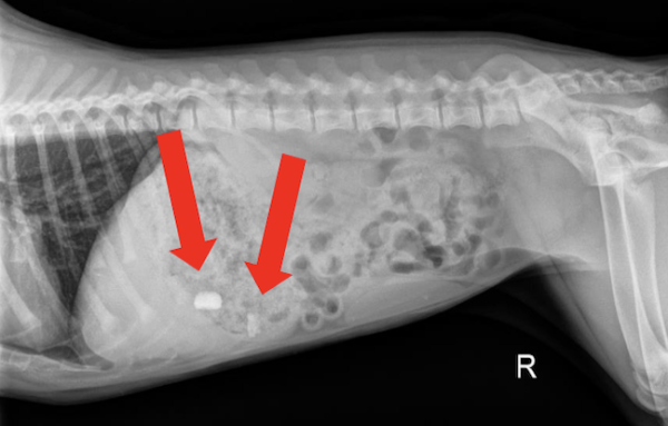 Right Lateral Abdomen